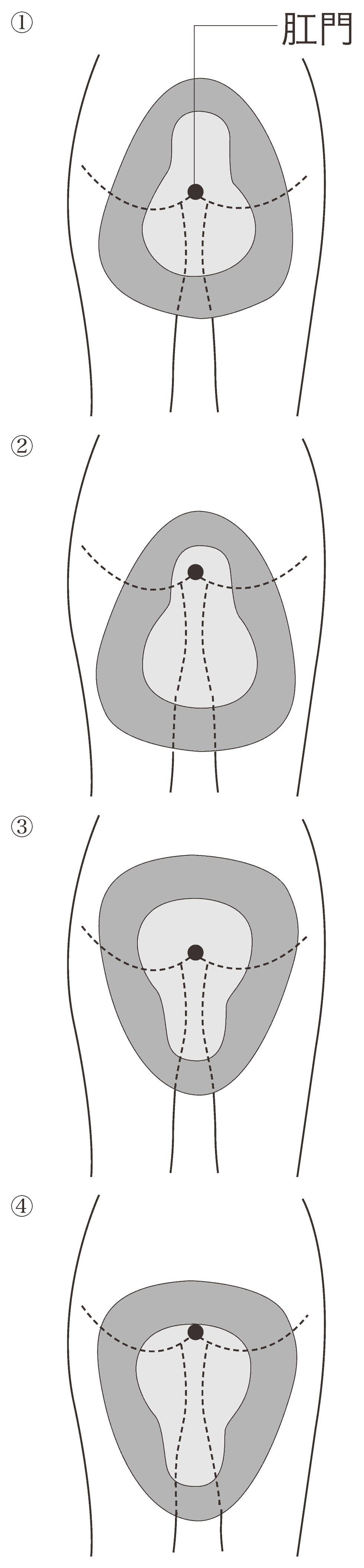 差し込み 便器 使い方 看護